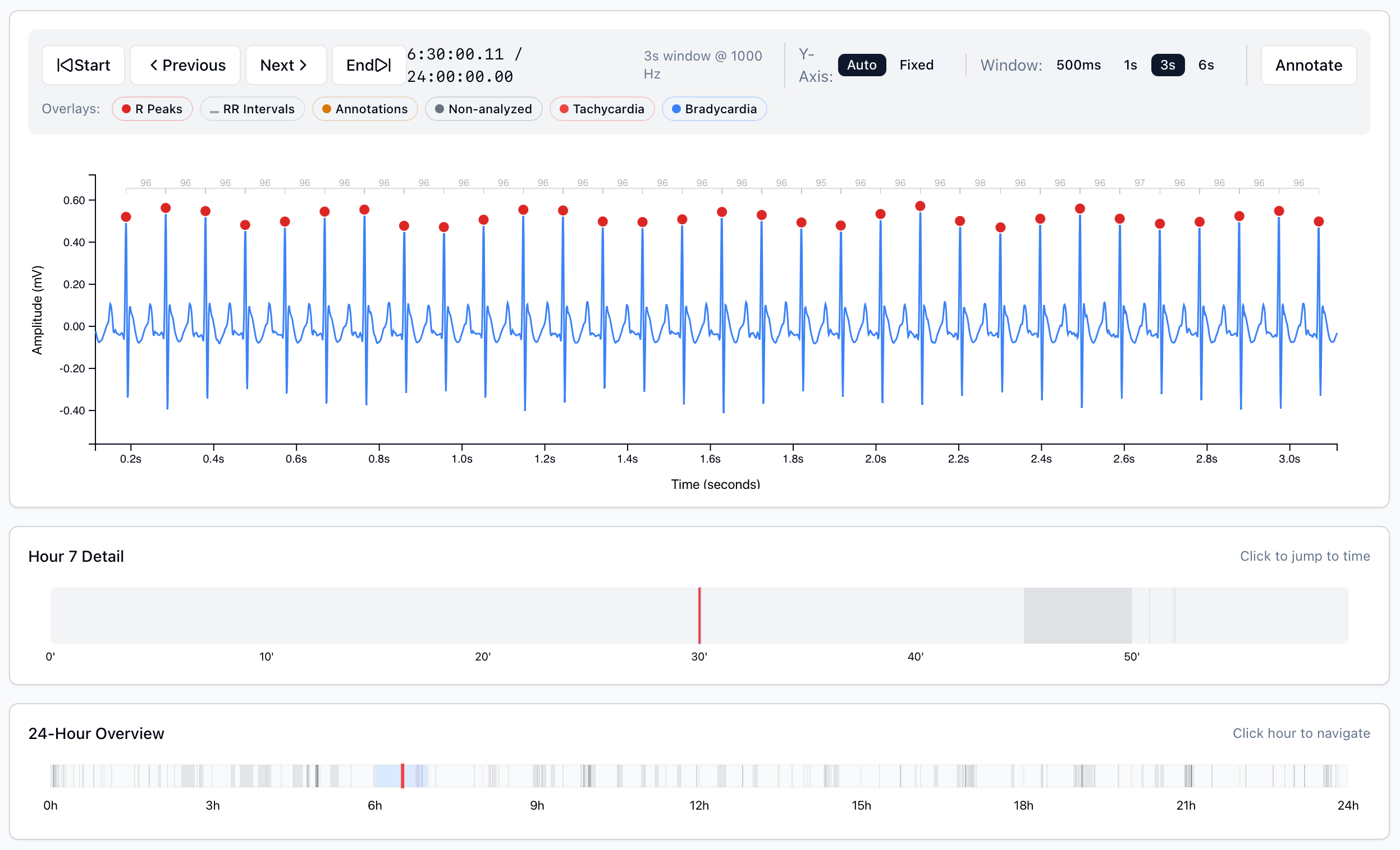 Jerry Research Platform — 24-hour Mouse ECG Analysis